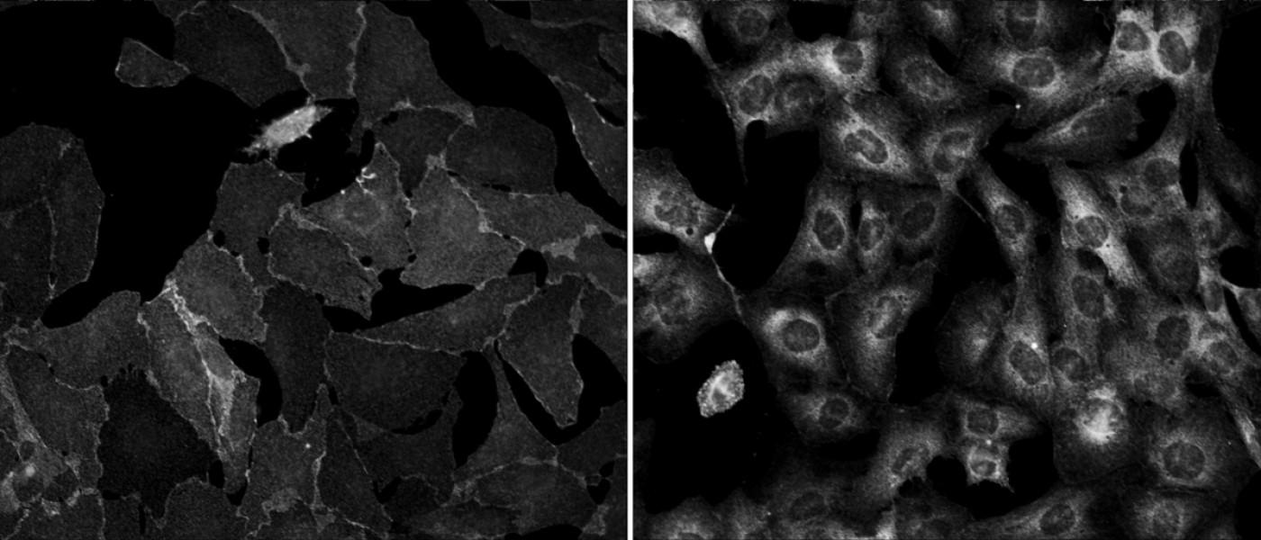 显微镜下细胞的黑白图像